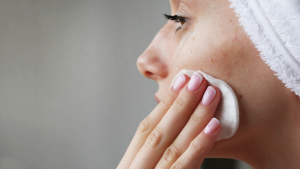 Acne Skin Care Tips