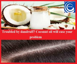 Troubled by dandruff? Coconut oil will ease your problem